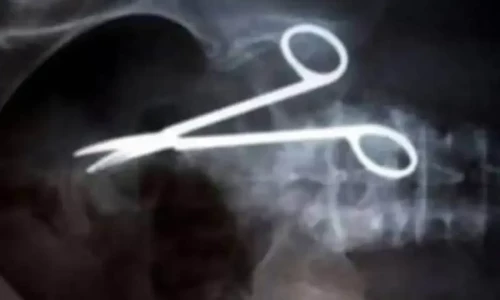 Faisalabad woman dies after doctors leave scissors in abdomen