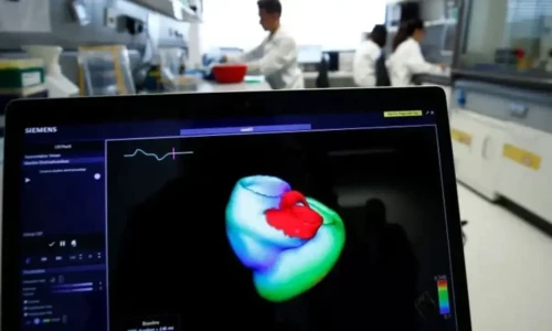 Why heart attacks are increasing in young adults?