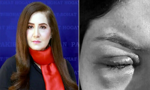 سینئر ٹی وی اینکر جیسمین منظور کا سابق شوہر پر بدترین گھریلو تشدد کا الزام، تصاویر شیئر کردیں