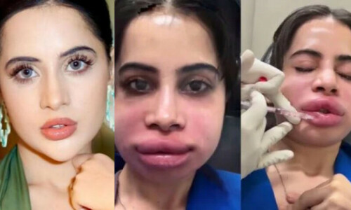 عرفی جاوید کی لِپ فلرز سرجری کی نئی چونکا دینے والی ویڈیو وائرل