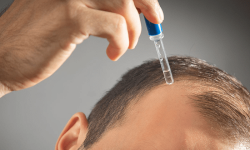 کیا یہ دوائی دنیا سے گنج پن کا خاتمہ کردے گی؟