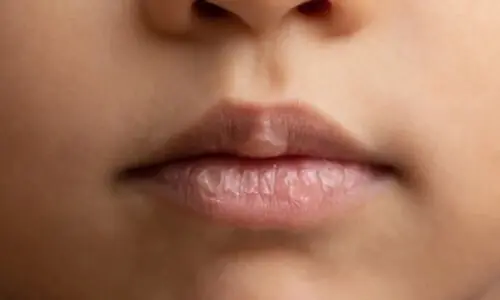 سردی میں ہونٹ سیاہ ہو جاتے ہیں؟ ان 6 آسان دیسی نسخوں سے ہونٹوں کو قدرتی گلابی رنگ دیں سردی میں ہونٹ سیاہ ہو جاتے ہیں؟ ان 6 آسان دیسی نسخوں سے ہونٹوں کو قدرتی گلابی رنگ دیں