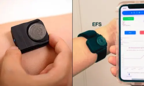 ٹیسٹ کے لیے خون نکالنے سے نجات: جِلد کی سانسیں بتائیں گی نتیجہ