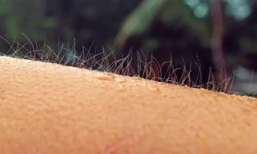 ڈر یا جوش میں انسانوں کے رونگٹے کیوں کھڑے ہوتے ہیں؟