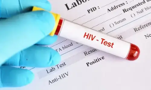 Pakistan sees alarming surge in HIV/AIDS cases, experts raise concern