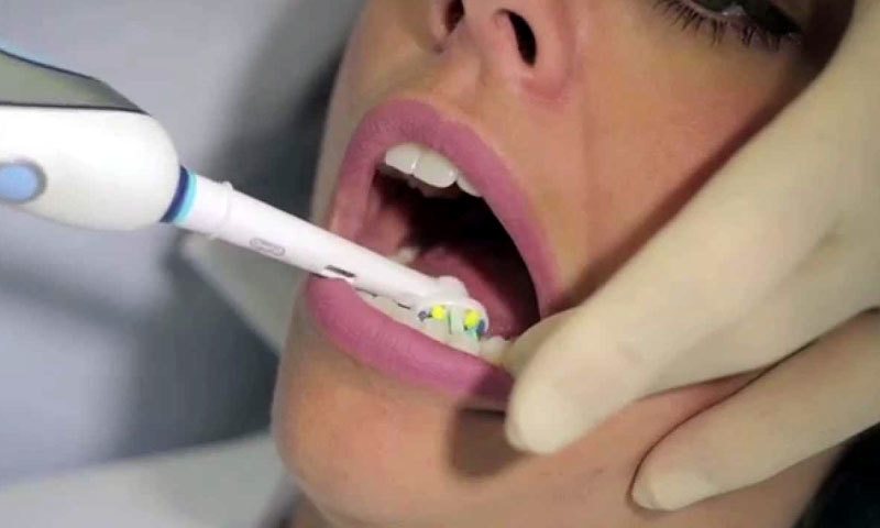 باقاعدگی سے دانت برش نہ کرنے والوں کے جسم میں کیا تبدیلی آتی ہے؟