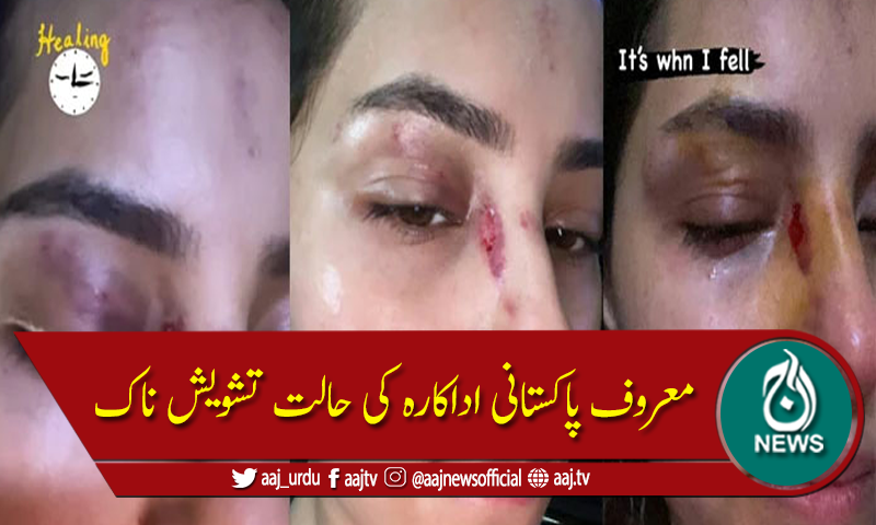 اداکارہ نمرہ خان کی حالت تشویشناک، مداحوں سے دعا کی اپیل