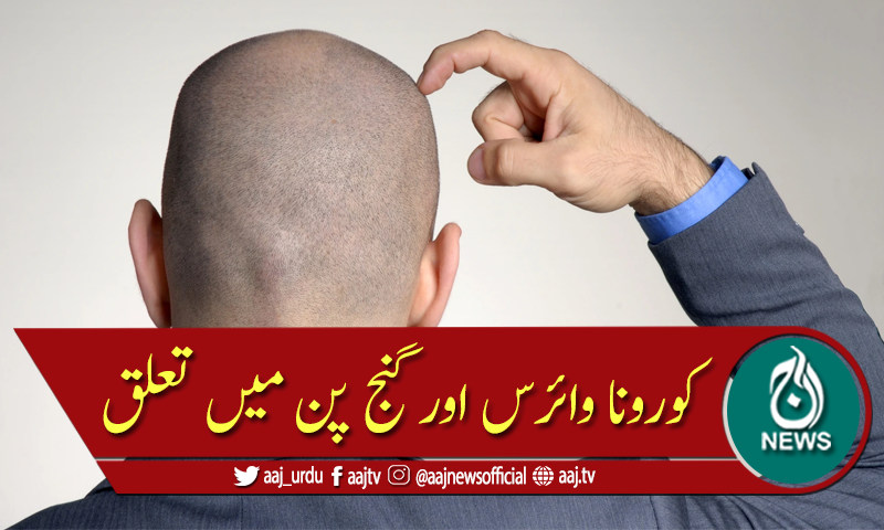 کیا کورونا وائرس اور گنج پن میں کوئی تعلق ہے؟