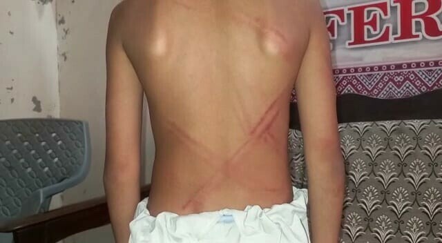 بدین میں مدرسے کے استاد کا چھٹی کرنے پرطالبعلم پروحشیانہ تشدد