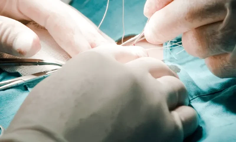 90 افراد کے گردوں کی غیر قانونی پیوندکاری میں ملوث گروہ کے 4 ارکان گرفتار