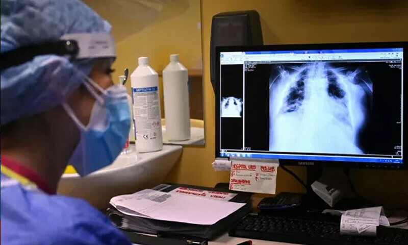 پنجاب میں نمونیہ بے قابو، 7 روز میں 85 اموات