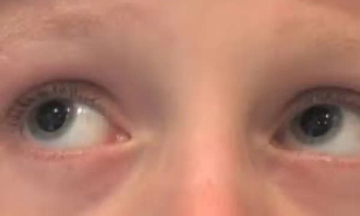 سائنسدانوں نے بچپن کی نابینائی کا حل تلاش کرلیا