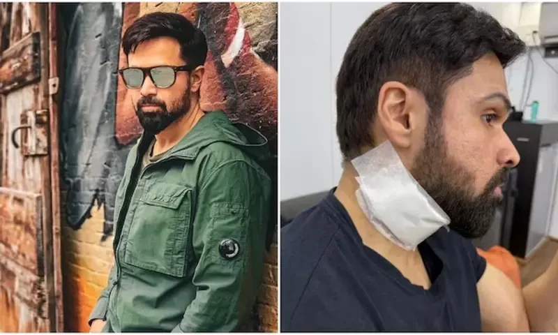 عمران ہاشمی ایکشن سین کی شوٹنگ کے دوران زخمی ہو گئے