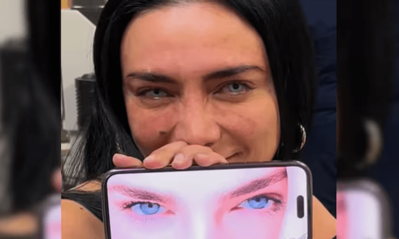 آنکھوں کا رنگ تبدیل کرنیوالی مہنگی سرجری نے گاہکوں کو حیران کر دیا