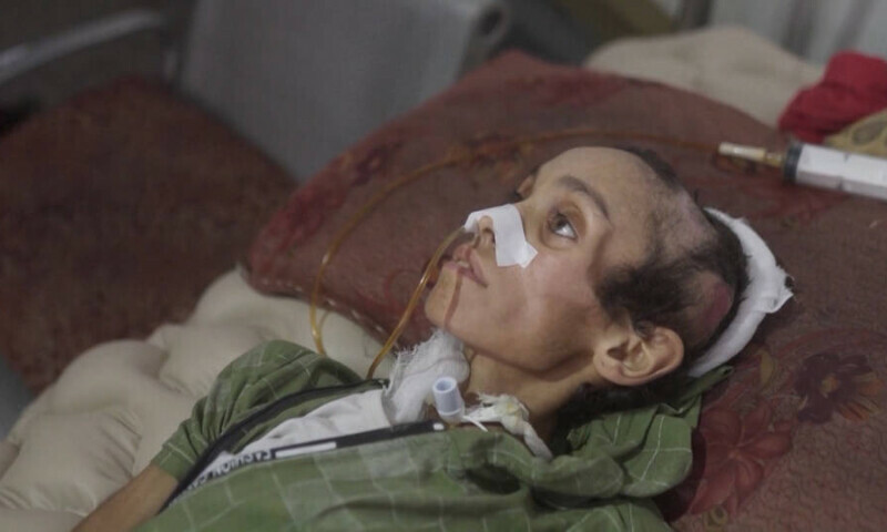 غزہ میں غذائی قلت اور فاقہ کشی سے 4 بچوں سمیت 15 افراد شہید