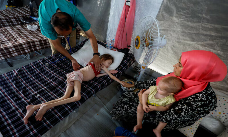 A doctor checks Jana Ayad, a malnourished Palestinian girl, at the International Medical Corps field hospital in Deir Al Balah in the southern Gaza Strip. – Reuters A doctor checks Jana Ayad, a malnourished Palestinian girl, at the International Medical Corps field hospital in Deir Al Balah in the southern Gaza Strip. – Reuters