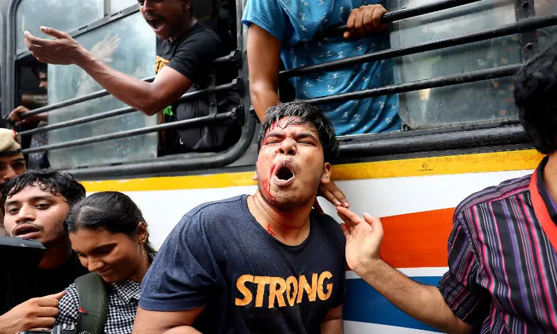 An injured demonstrator reacts in New Delhi. -- Reuters An injured demonstrator reacts in New Delhi. -- Reuters