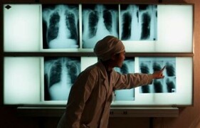 New treatment emerges for drug-resistant TB