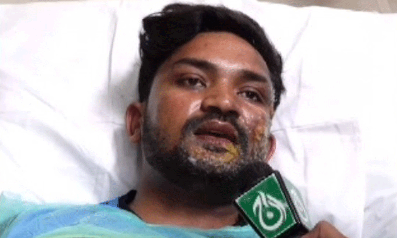 کراچی پولیس آفس حملہ؛ آخری فلور پر دہشتگرد کے پاس بہت اسلحہ تھا، زخمی رینجرز اہلکار