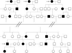 Young heart attack disorder under-diagnosed in Pakistan: Lancet