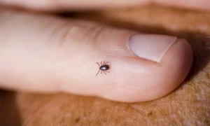 کوئٹہ میں کانگو وائرس سے افغان خاتون جاں بحق