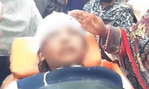 ملازمہ تشدد کیس: سرجری کیلئے رضوانہ کے زخموں سے انفیکشن کے خاتمے کا انتظار