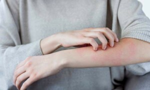 جلد پرخارش کی عام اقسام کون سی ہیں اور ان سے بچاؤ کیسے ممکن ہے؟