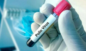 سبی اور پشاور میں ماحولیاتی نمونوں میں پولیو وائرس کی تصدیق