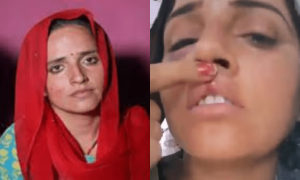 کیا سیما حیدر پر بھارتی شوہر نے تشدد کیا؟ زخمی ہونے کی تصاویر وائرل