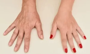 ہاتھوں پر بڑھتی عمر کی علامات کو کم کرنے کی مفید تجاویز