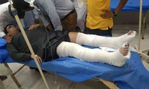 حافظ آباد: ہوٹل کی لفٹ گرنے سے سول جج کی دونوں ٹانگیں ٹوٹ گئیں، اہلیہ بھی زخمی