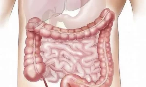 اپنی آنتوں کی صحت کو آسان ہوم میڈی ڈرنکس سے بہتر بنائیں