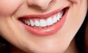 دانتوں کی پیلاہٹ دور کرنے کے 6 طریقے