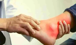جسم سے یورک ایسیڈ کوکم کرنے کے 7 آسان طریقے