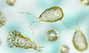 Another teen dies of Naegleria in Karachi, 2025 death toll rises to four