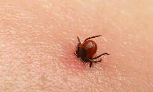 Another Congo virus case reported in Karachi