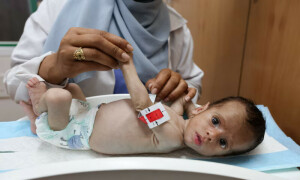 Skin over bone: Children starving as Gaza edges closer to famine