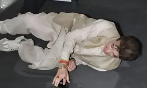 تعزیت پر گئے جیتندر سیڑھیوں سے گر گئے، اب کس حال میں ہیں؟