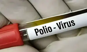 Polio threat rises in Lahore as virus detected in sewage samples