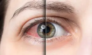 عمران خان کی آنکھ میں ہونے والا انفیکشن &rsquo;سینٹرل ریٹینل وین اوکلژن&lsquo; کیا ہے؟