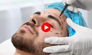 مردوں میں پلاسٹک سرجری کے رجحان میں اضافہ