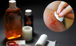 زخم پر ایکسپائرڈ اینٹی سیپٹک لگالیں تو کیا ہوسکتا ہے؟