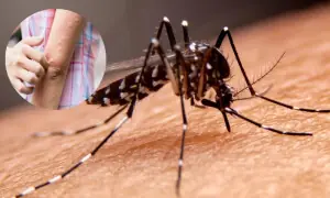 مچھر آپ کو ہی کیوں کاٹتے ہیں؟ وہ وجوہات جو آپ کو پسندیدہ ڈنر بناتی ہیں