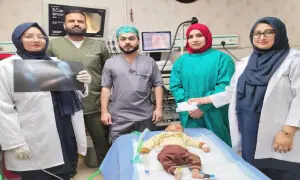 Infant saved as surgeons remove metal washer from stomach in Lahore Infant saved as surgeons remove metal washer from stomach in Lahore