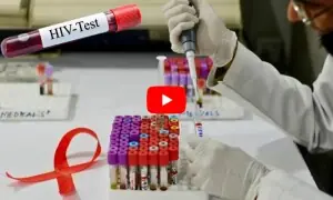 پاکستان میں ایڈز کا پھیلاؤ تیز، وجہ کیا ہے؟