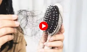 تیزی سے گرتے بالوں کی وجہ اور علاج