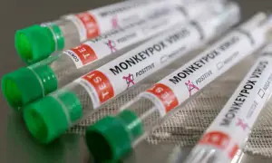 Karachi records ninth mpox case as local transmission feared