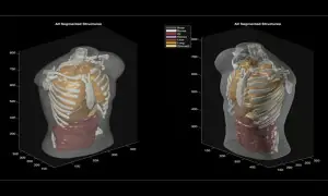 AI behind viral images moves into healthcare with 60-second full-body scanner