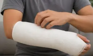 فریکچر کے بعد پلاسٹر میں خارش ہو تو کیا کریں؟ آسان اور مختصر طریقے
