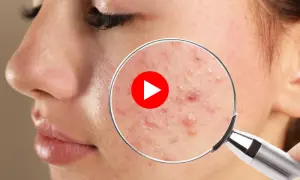 اسکن ٹریٹمنٹ سے پہلے مکمل جسمانی طبی معائنہ ضروری کیوں؟